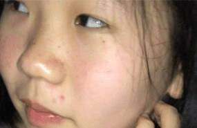 684[11v/1.4G/度盘]